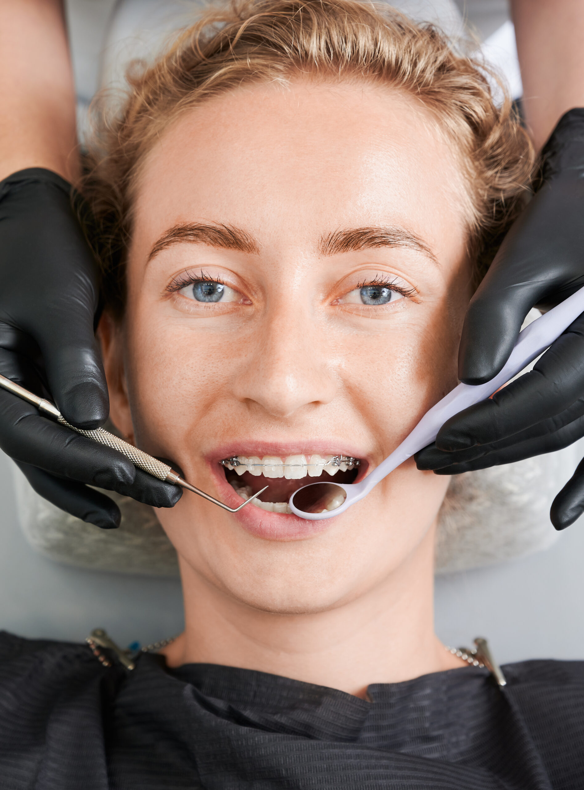 Why Choose Orthodontic Treatment?